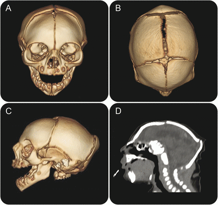 Divulgação/Neurology