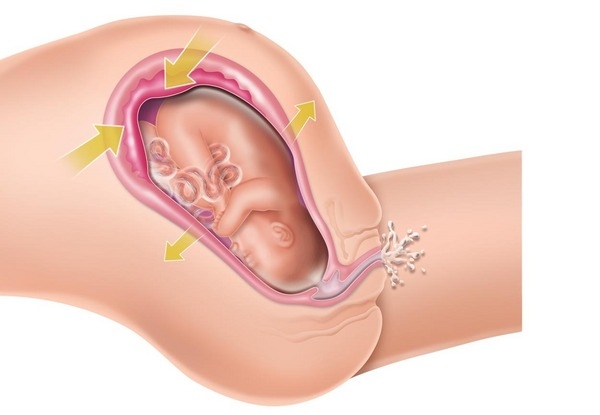 2ª fase: expulsão 2ª fase: expulsão
