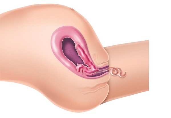 4ª fase: Greenberg 4ª fase: Greenberg