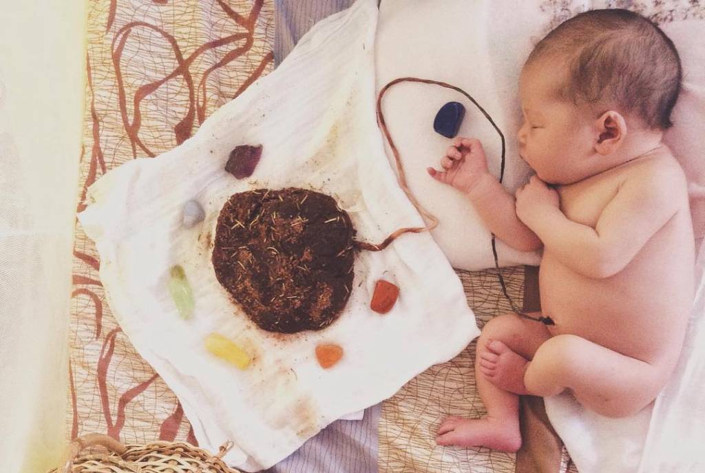 Parto de Lótus: veja fotos de recém-nascidos ligados à placenta