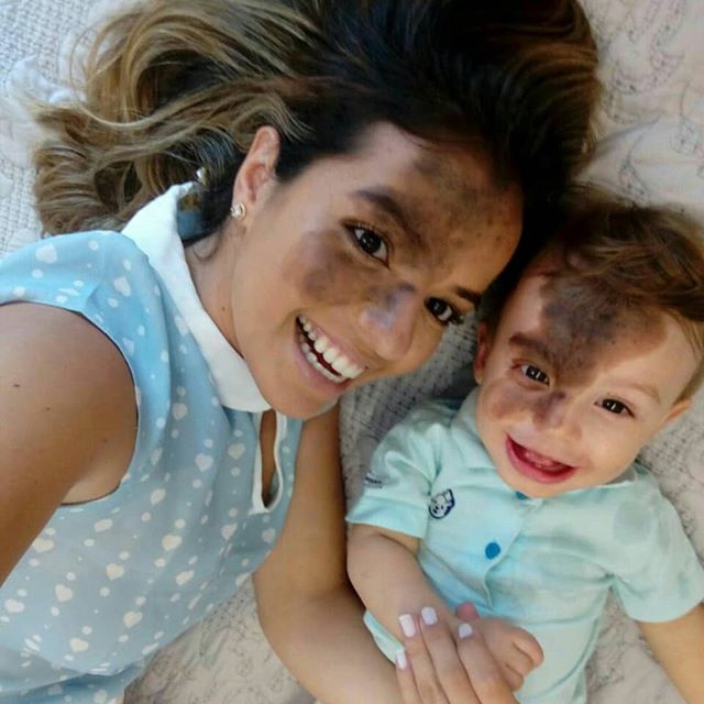 Mãe faz maquiagem para homenagear filho que nasceu com mancha no rosto