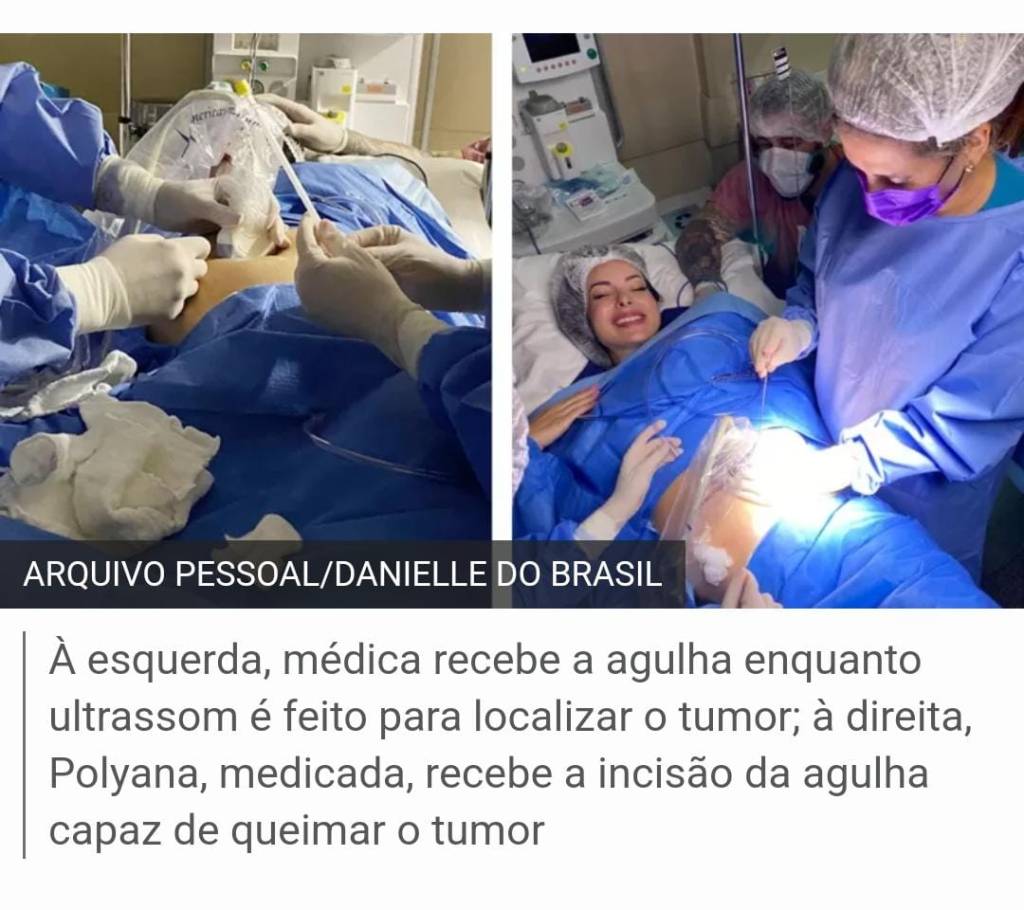 cirurgia-fetal cirurgia fetal