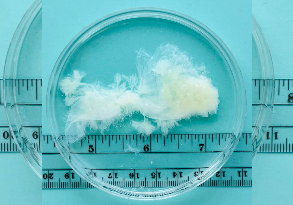 Imagens reais mostram material gestacional até a 9ª semana de gravidez