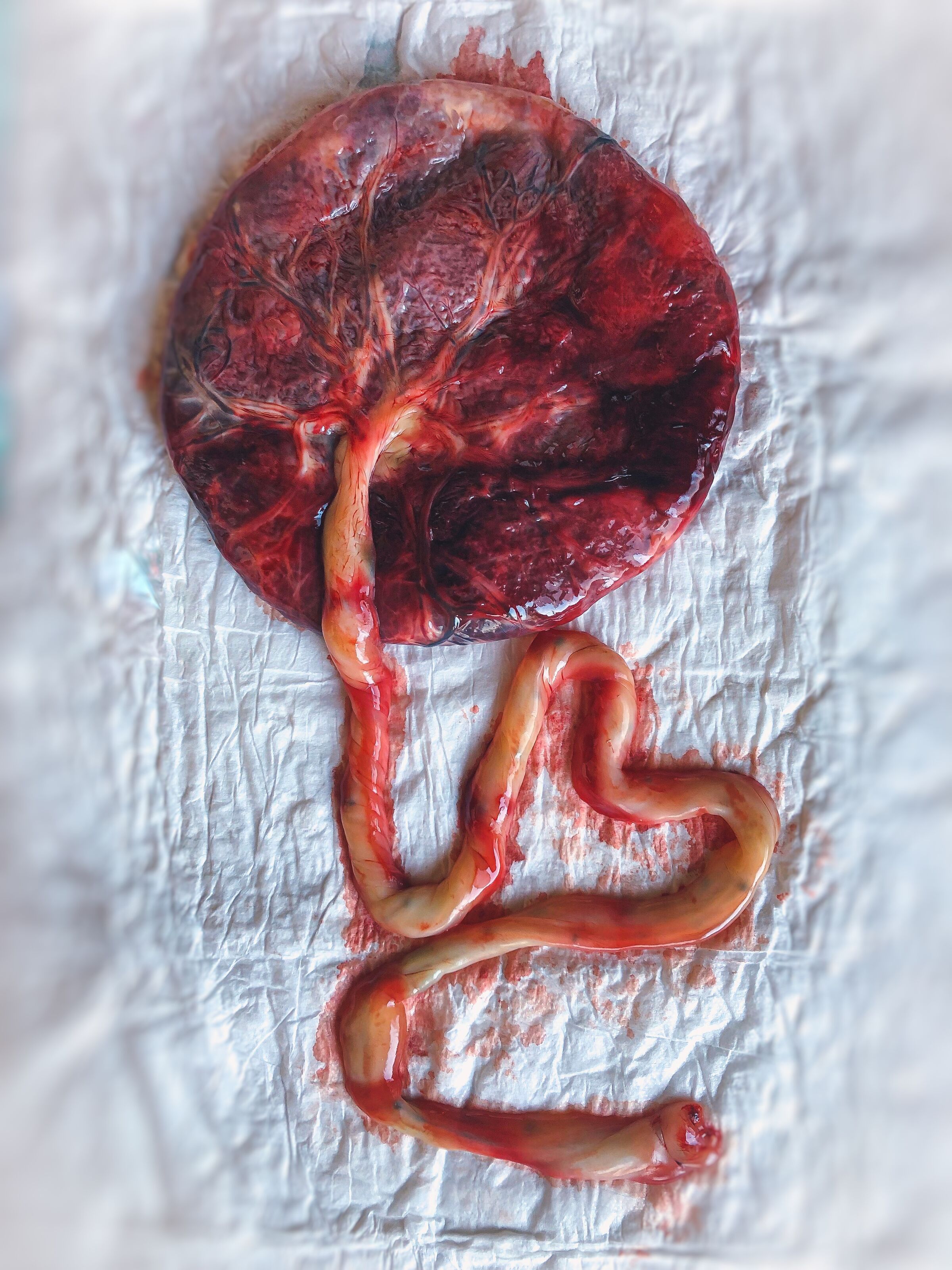 placenta que ser&aacute; carimbada