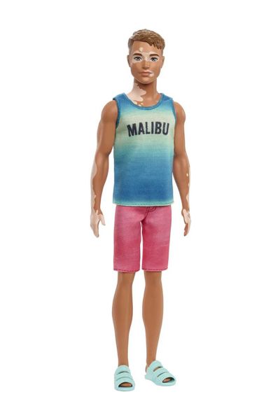 Boneco Ken Fashionistas vitiligo