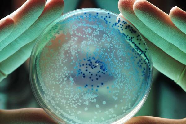 Escherichia coli: o que você precisa saber sobre essa bactéria