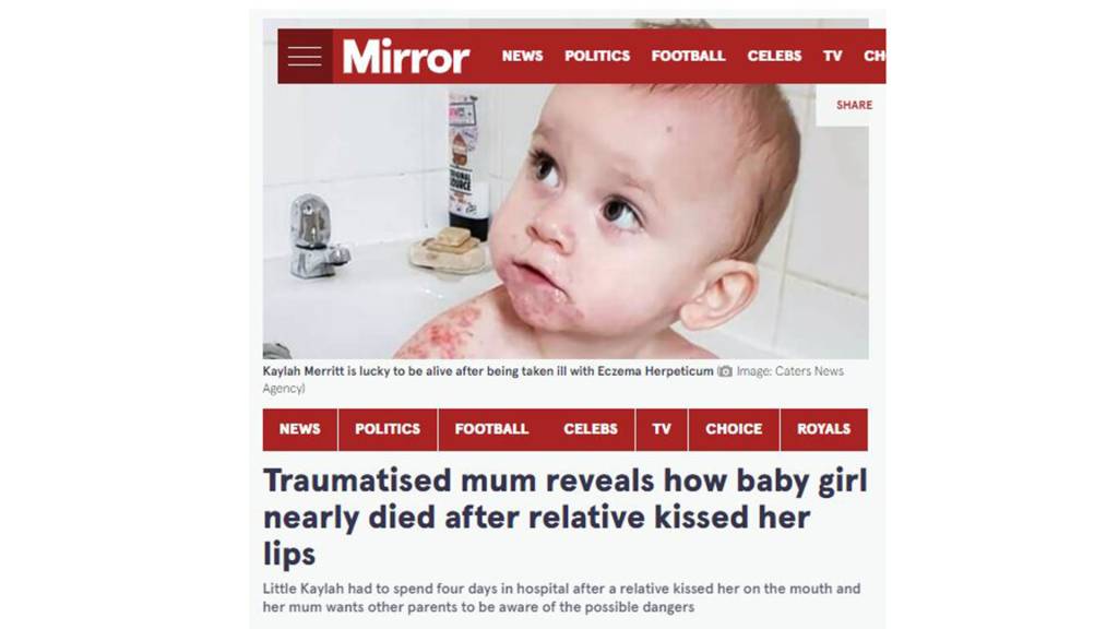 bebe-quase-morre-parente-beijo-boca print da página de um site com a imagem de uma bebê com a boca e os ombros cheios de bolinhas